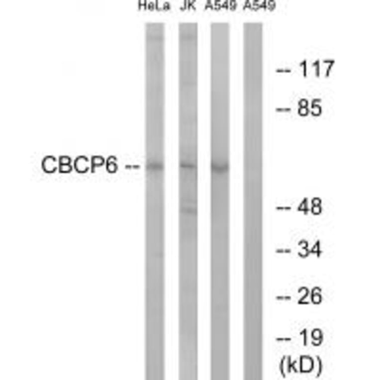 Western blot - CBCP6 Antibody from Signalway Antibody (34638) - Antibodies.com