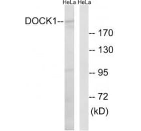 Western blot - DOCK1 Antibody from Signalway Antibody (34642) - Antibodies.com