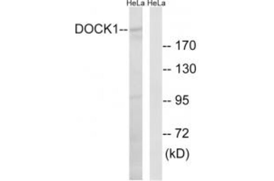 Western blot - DOCK1 Antibody from Signalway Antibody (34642) - Antibodies.com
