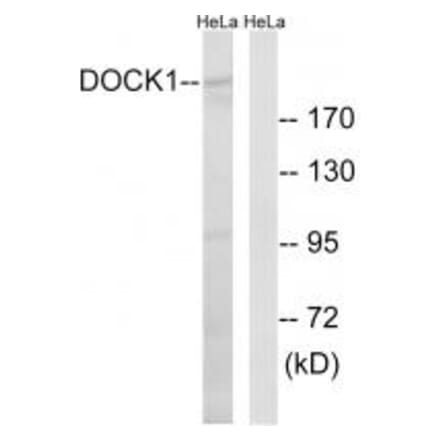 Western blot - DOCK1 Antibody from Signalway Antibody (34642) - Antibodies.com
