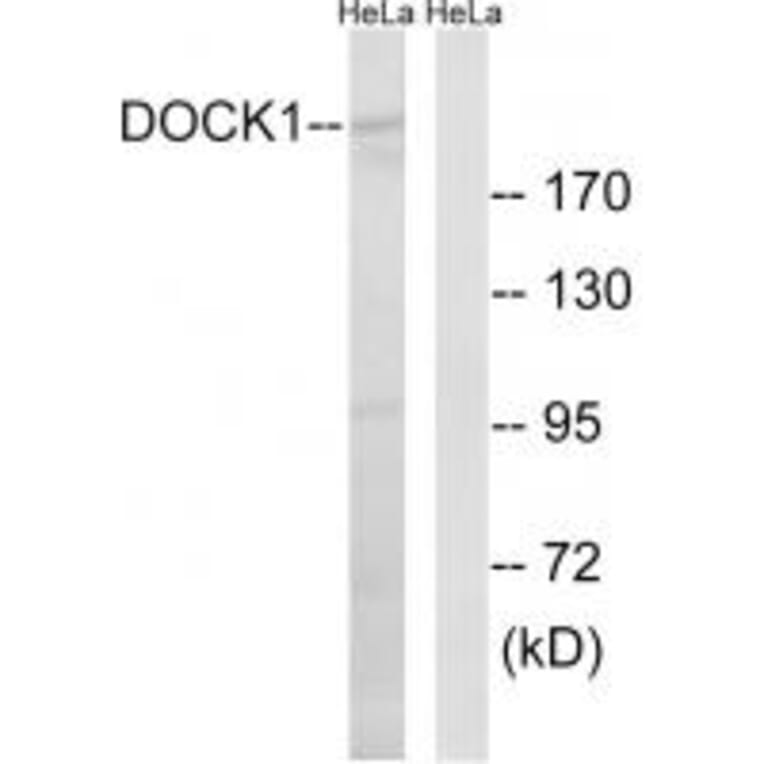Western blot - DOCK1 Antibody from Signalway Antibody (34642) - Antibodies.com