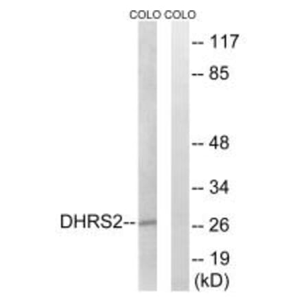 Western blot - DHRS2 Antibody from Signalway Antibody (34643) - Antibodies.com