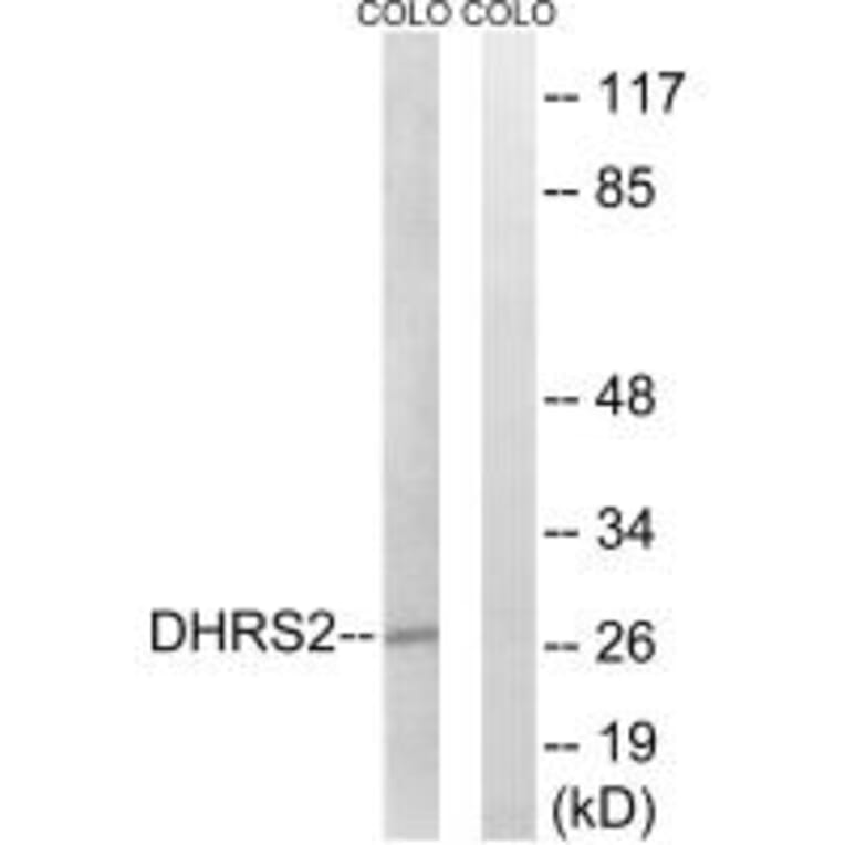 Western blot - DHRS2 Antibody from Signalway Antibody (34643) - Antibodies.com
