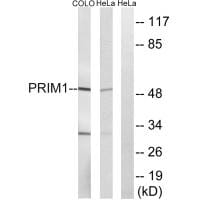 Western blot analysis of extracts from HepG2 cells, using PRIM1 antibody #34649.
