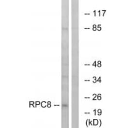 Western blot - RPC8 Antibody from Signalway Antibody (34656) - Antibodies.com