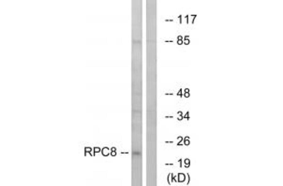 Western blot - RPC8 Antibody from Signalway Antibody (34656) - Antibodies.com