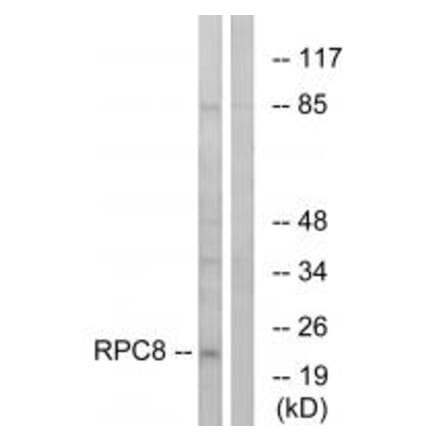 Western blot - RPC8 Antibody from Signalway Antibody (34656) - Antibodies.com