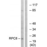 Western blot - RPC8 Antibody from Signalway Antibody (34656) - Antibodies.com