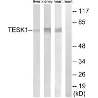 Western blot analysis of extracts from rat heart cells, rat kidney cells and rat liver cells, using TESK1 antibody #34659.