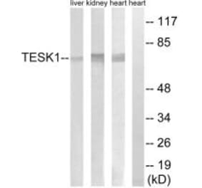 Western blot - TESK1 Antibody from Signalway Antibody (34659) - Antibodies.com