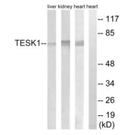 Western blot - TESK1 Antibody from Signalway Antibody (34659) - Antibodies.com