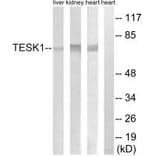 Western blot - TESK1 Antibody from Signalway Antibody (34659) - Antibodies.com