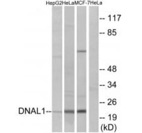 Western blot - DNAL1 Antibody from Signalway Antibody (34660) - Antibodies.com