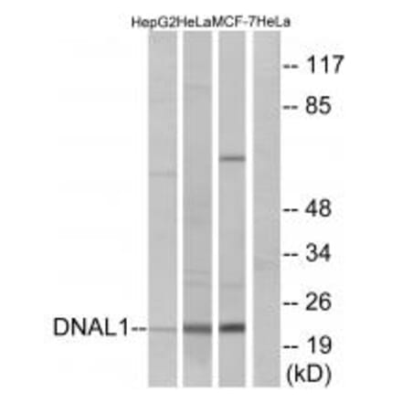 Western blot - DNAL1 Antibody from Signalway Antibody (34660) - Antibodies.com