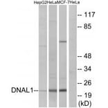 Western blot - DNAL1 Antibody from Signalway Antibody (34660) - Antibodies.com