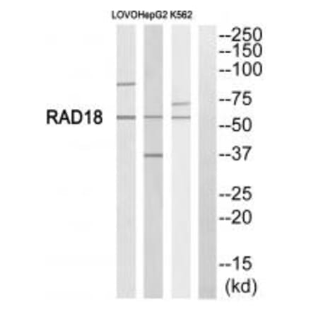 Western blot - RAD18 Antibody from Signalway Antibody (34662) - Antibodies.com