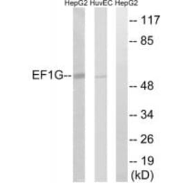 Western blot - EEF1G Antibody from Signalway Antibody (34667) - Antibodies.com