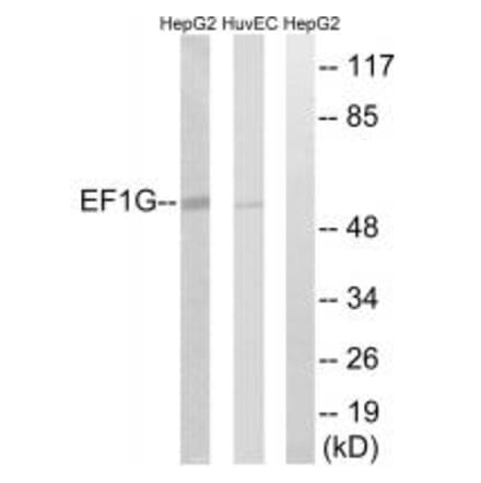 Western blot - EEF1G Antibody from Signalway Antibody (34667) - Antibodies.com