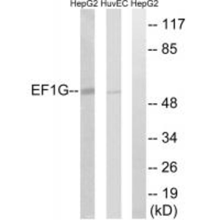 Western blot - EEF1G Antibody from Signalway Antibody (34667) - Antibodies.com