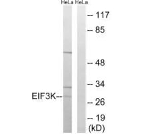 Western blot - EIF3K Antibody from Signalway Antibody (34680) - Antibodies.com