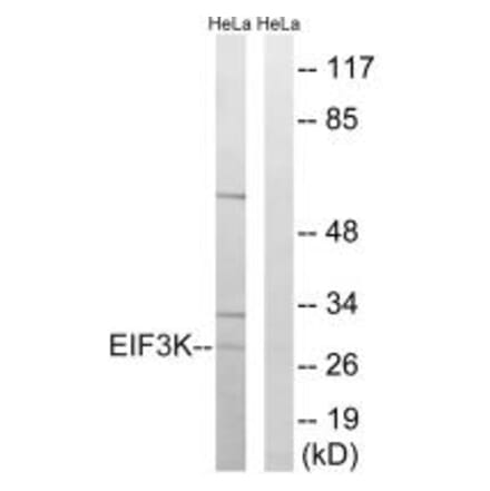 Western blot - EIF3K Antibody from Signalway Antibody (34680) - Antibodies.com