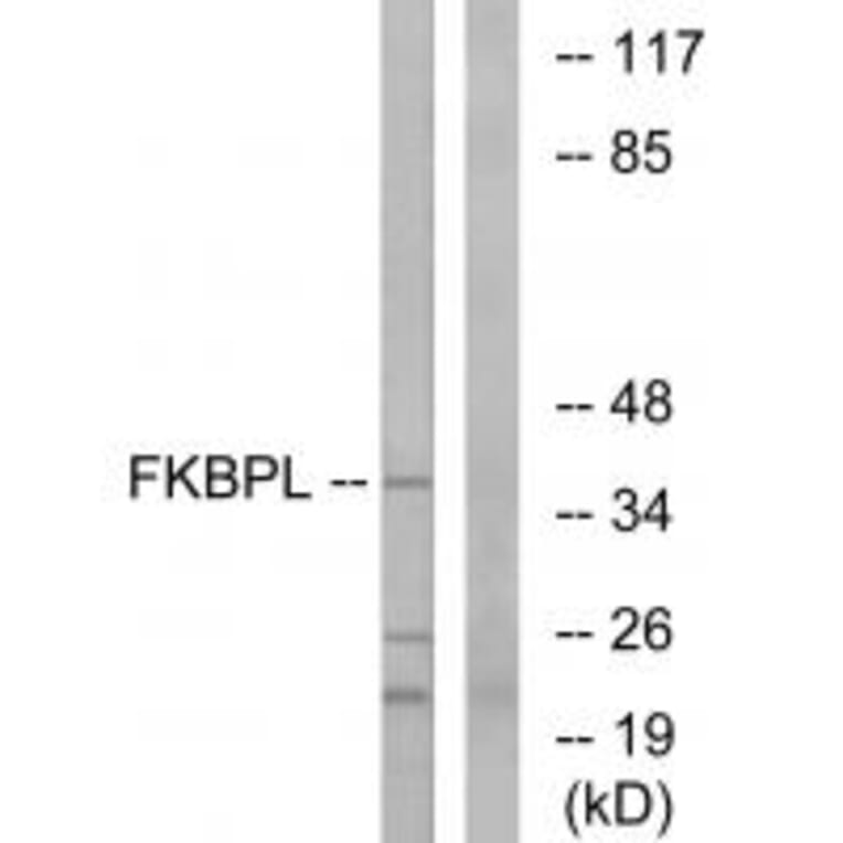 Western blot - FKBPL Antibody from Signalway Antibody (34682) - Antibodies.com