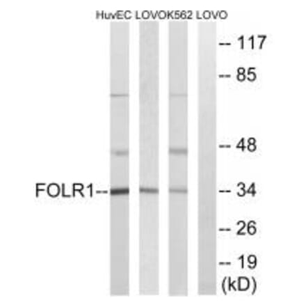 Western blot - FOLR1 Antibody from Signalway Antibody (34683) - Antibodies.com