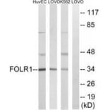 Western blot - FOLR1 Antibody from Signalway Antibody (34683) - Antibodies.com