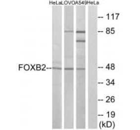 Western blot - FOXB2 Antibody from Signalway Antibody (34684) - Antibodies.com