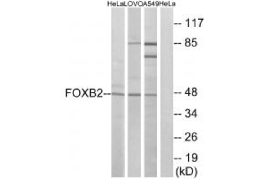 Western blot - FOXB2 Antibody from Signalway Antibody (34684) - Antibodies.com