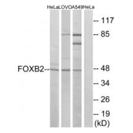 Western blot - FOXB2 Antibody from Signalway Antibody (34684) - Antibodies.com
