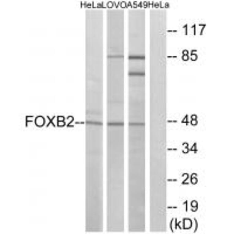 Western blot - FOXB2 Antibody from Signalway Antibody (34684) - Antibodies.com