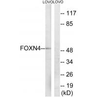 Western blot analysis of extracts from LOVO cells, using FOXN4 antibody #34686.