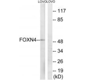 Western blot - FOXN4 Antibody from Signalway Antibody (34686) - Antibodies.com