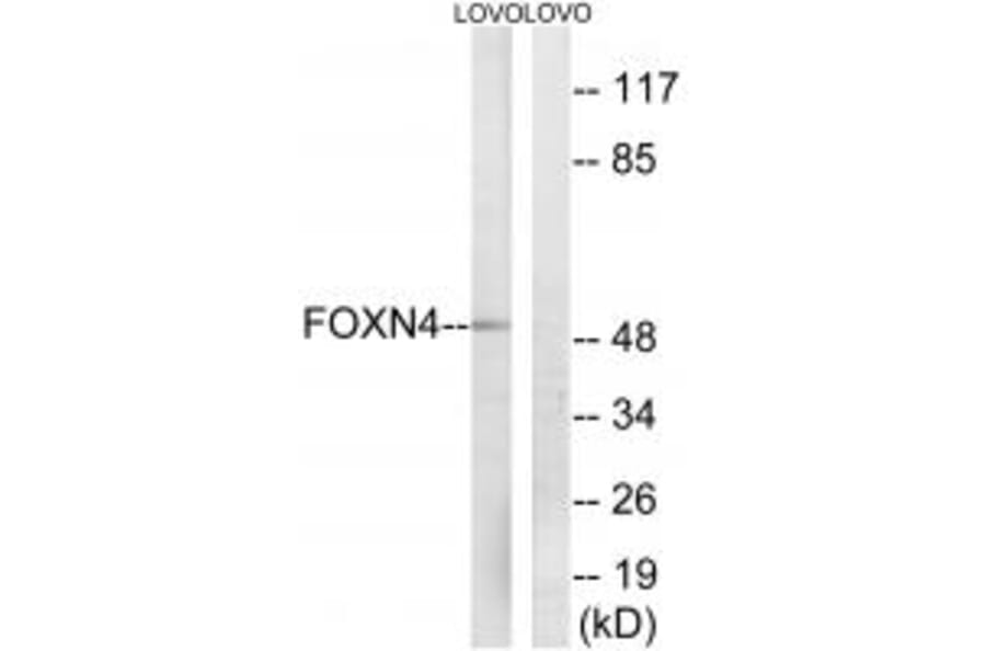 Western blot - FOXN4 Antibody from Signalway Antibody (34686) - Antibodies.com