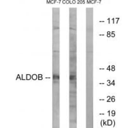 Western blot - ALDOB Antibody from Signalway Antibody (34688) - Antibodies.com