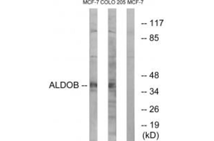 Western blot - ALDOB Antibody from Signalway Antibody (34688) - Antibodies.com
