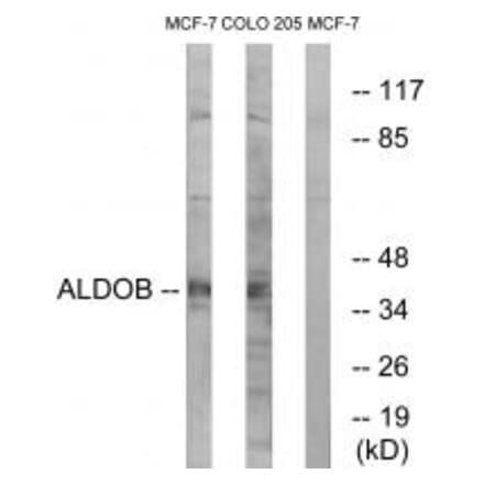 Western blot - ALDOB Antibody from Signalway Antibody (34688) - Antibodies.com