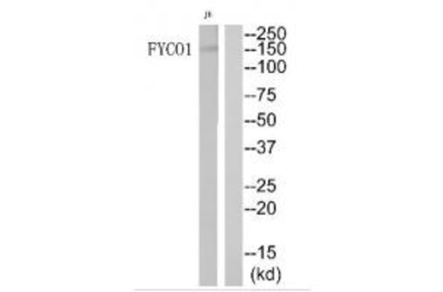 Western blot - FYCO1 Antibody from Signalway Antibody (34690) - Antibodies.com