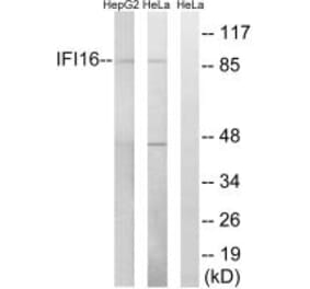 Western blot - IFI16 Antibody from Signalway Antibody (34696) - Antibodies.com