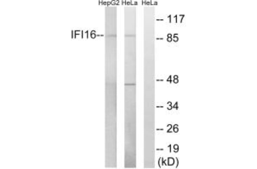 Western blot - IFI16 Antibody from Signalway Antibody (34696) - Antibodies.com