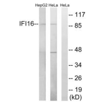 Western blot - IFI16 Antibody from Signalway Antibody (34696) - Antibodies.com