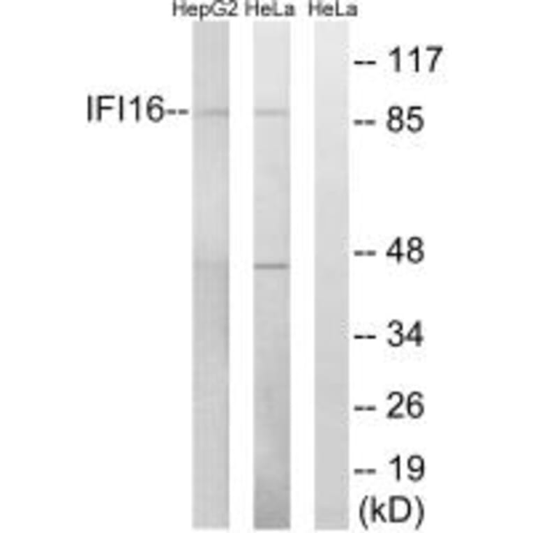 Western blot - IFI16 Antibody from Signalway Antibody (34696) - Antibodies.com