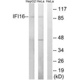 Western blot - IFI16 Antibody from Signalway Antibody (34696) - Antibodies.com