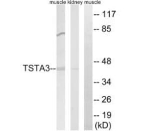 Western blot - TSTA3 Antibody from Signalway Antibody (34703) - Antibodies.com