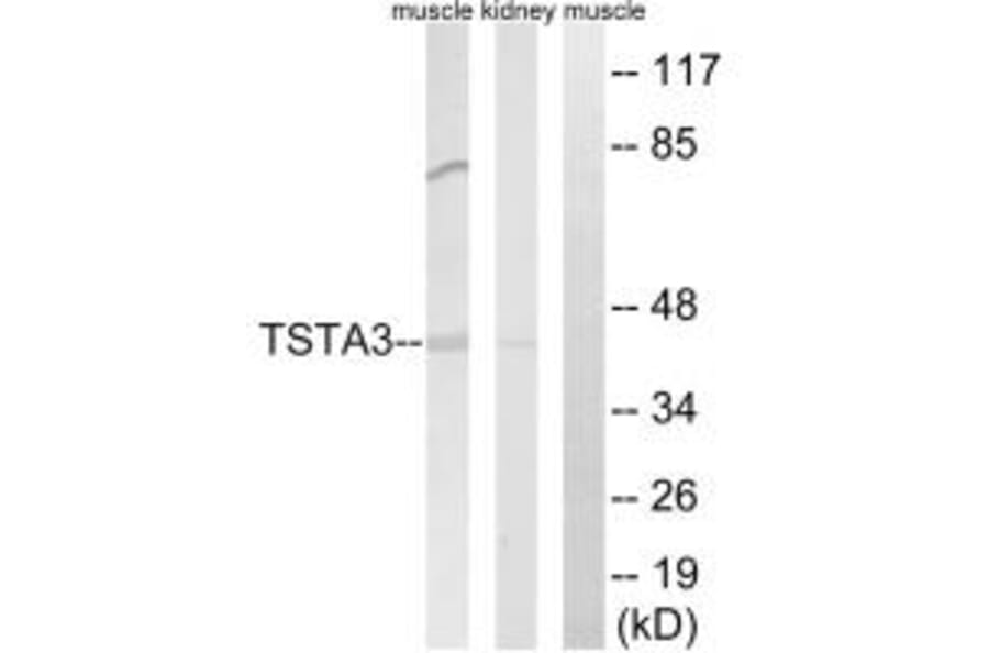 Western blot - TSTA3 Antibody from Signalway Antibody (34703) - Antibodies.com