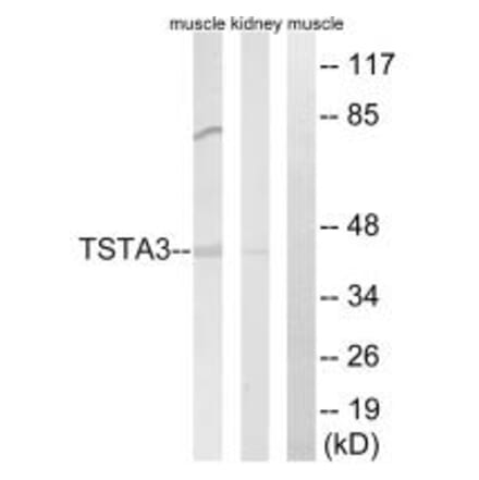Western blot - TSTA3 Antibody from Signalway Antibody (34703) - Antibodies.com