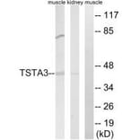 Western blot - TSTA3 Antibody from Signalway Antibody (34703) - Antibodies.com