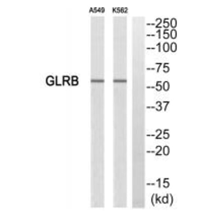 Western blot - GLRB Antibody from Signalway Antibody (34705) - Antibodies.com