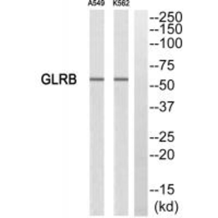 Western blot - GLRB Antibody from Signalway Antibody (34705) - Antibodies.com
